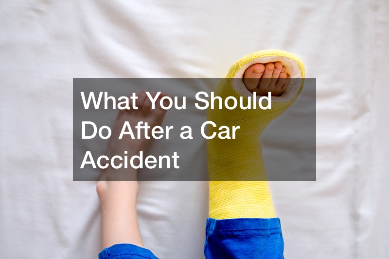 What You Should Do After A Car Accident Legal Magazine 6437